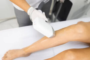 Cách sử dụng máy triệt lông Spa