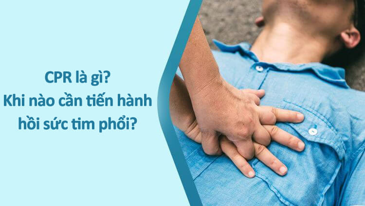 CPR là gì